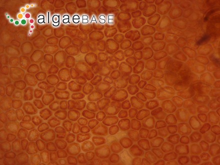 Neoabbottiella araneosa (Perestenko) S.C.Lindstrom