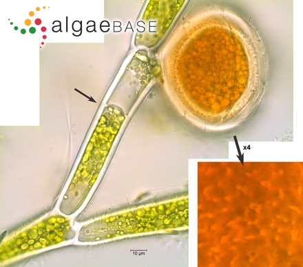 Nitzschia vermicularis var. minuta Playfair