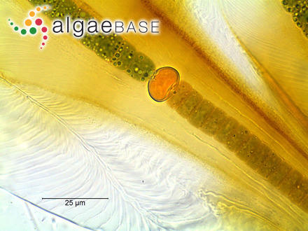 Eunotia pectinalis f. fossilis Manguin