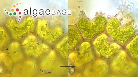 Eunotia cancellata f. mutabilis A.Cleve