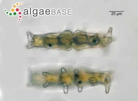Sphaerococcus subfuscus (Woodward) C.Agardh