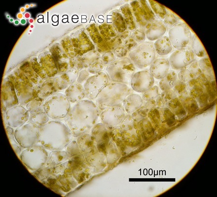 Myriogramme ciliata Yamada