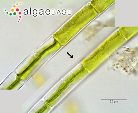 Stenopeltis liagoroides (Yamada) Itono & Yoshizaki