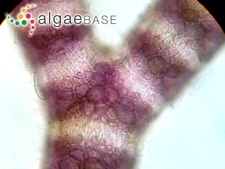 Actinella tasmaniensis Hustedt