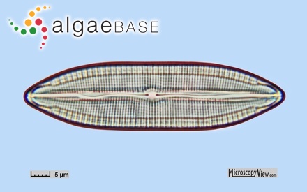 Strombomonas fluviatilis (Lemmermann) Deflandre