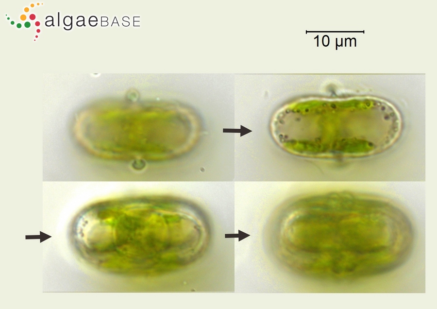 Sphaerozosma vertebratum Brébisson ex Ralfs