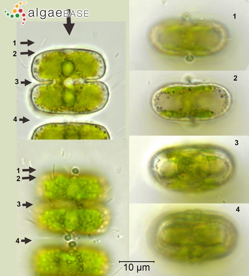 Sphaerozosma vertebratum Brébisson ex Ralfs