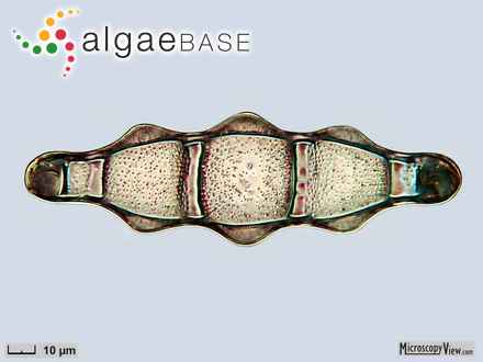 Biddulphiella capuzina (A.W.F.Schmidt ) P.A.Sims & M.P.Ashworth