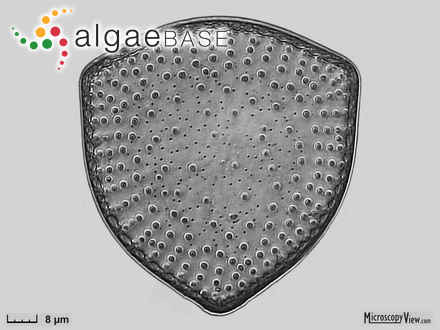 Stictodiscus gibbosus (Grove & Sturt) Hustedt