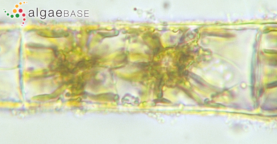 Bachelotia antillarum (Grunow) Gerloff