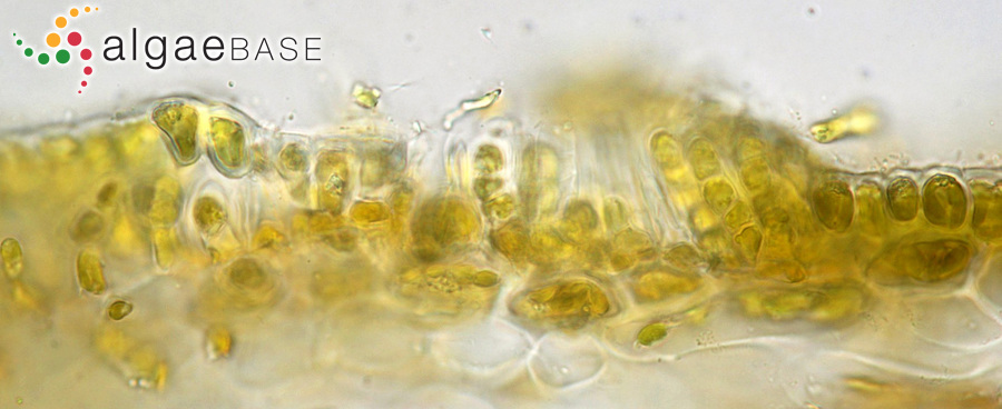 Laminariocolax aecidioides (Rosenvinge) A.F.Peters