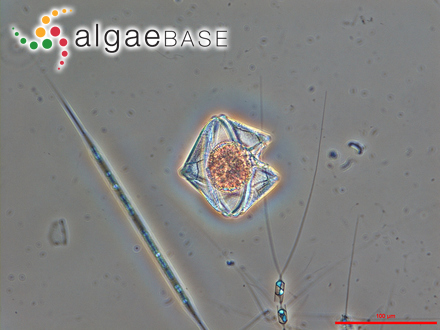 Protoperidinium conicum (Gran) Balech