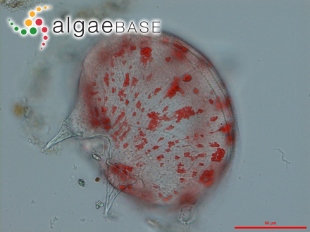 Protoperidinium depressum (Bailey) Balech