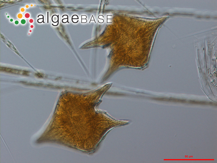 Protoperidinium divergens (Ehrenberg) Balech