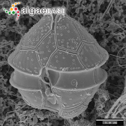 Ensiculifera tyrrhenica (Balech) Zhun Li, K.N.Mertens, Gottschling, H.Gu & H.H.Shin