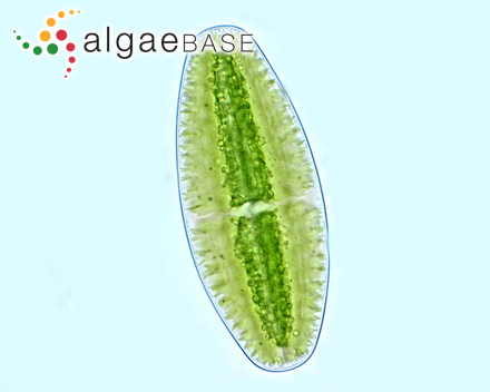 Netrium digitus (Brébisson ex Ralfs) Itzigsohn & Rothe