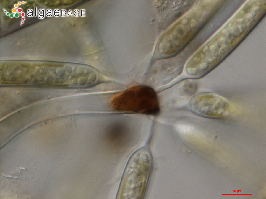Ophiocytium arbuscula (A.Braun ex Kützing) Sande Lacoste & Suringar