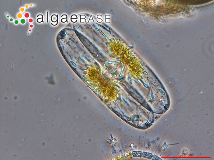 Membraneis challengeri (Grunow) Paddock