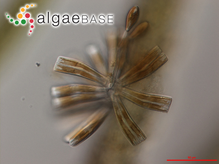 Rhoicosphenia abbreviata (C.Agardh) Lange-Bertalot