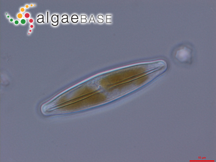 Frustulia vulgaris (Thwaites) De Toni