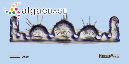 Biddulphiella rigida (A,Schmidt) P.A.Sims & M.P.Ashworth