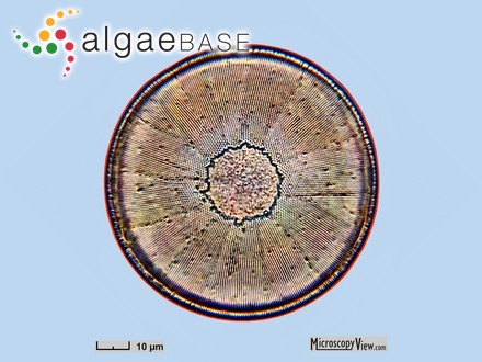 Podosira stelligera (Bailey) A.Mann