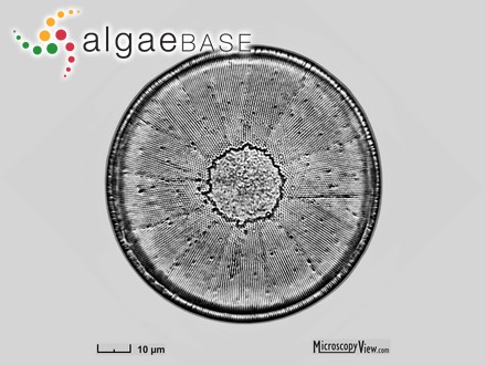 Podosira stelligera (Bailey) A.Mann