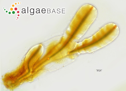 Petalonema alatum (Borzì ex Bornet & Flahault) Wolle