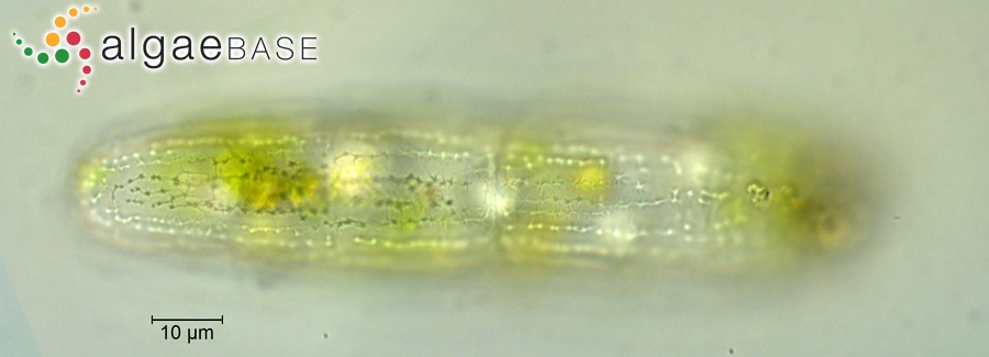 Penium margaritaceum Brébisson ex Ralfs