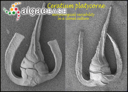 Tripos platycornis (Daday) F.Gómez