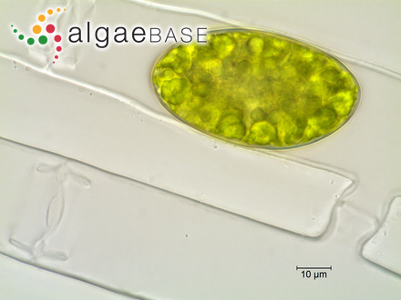 Spirogyra laxa Kützing