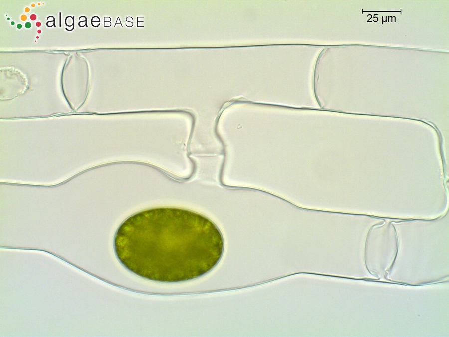 Spirogyra pellucida (Hassall) Kützing