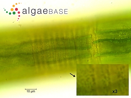 Closterium baillyanum (Brébisson ex Ralfs) Brébisson