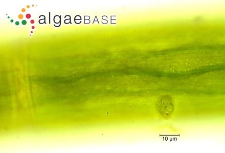 Closterium baillyanum (Brébisson ex Ralfs) Brébisson