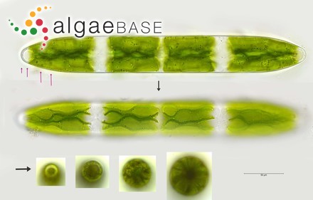 Netrium interruptum (Brébisson ex Ralfs) Lütkemüller