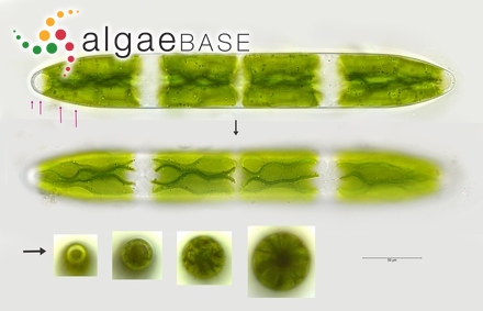 Netrium interruptum (Brébisson ex Ralfs) Lütkemüller