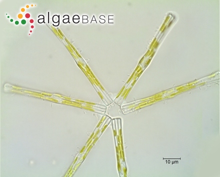 Tabellaria flocculosa var. asterionelloides (Grunow) Knudson