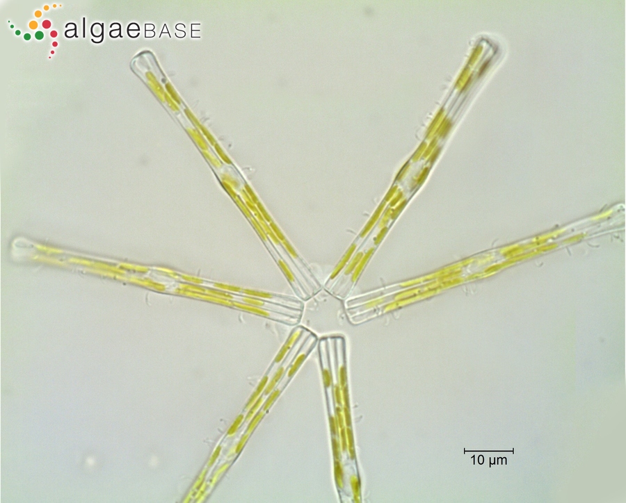 Tabellaria flocculosa var. asterionelloides (Grunow) Knudson