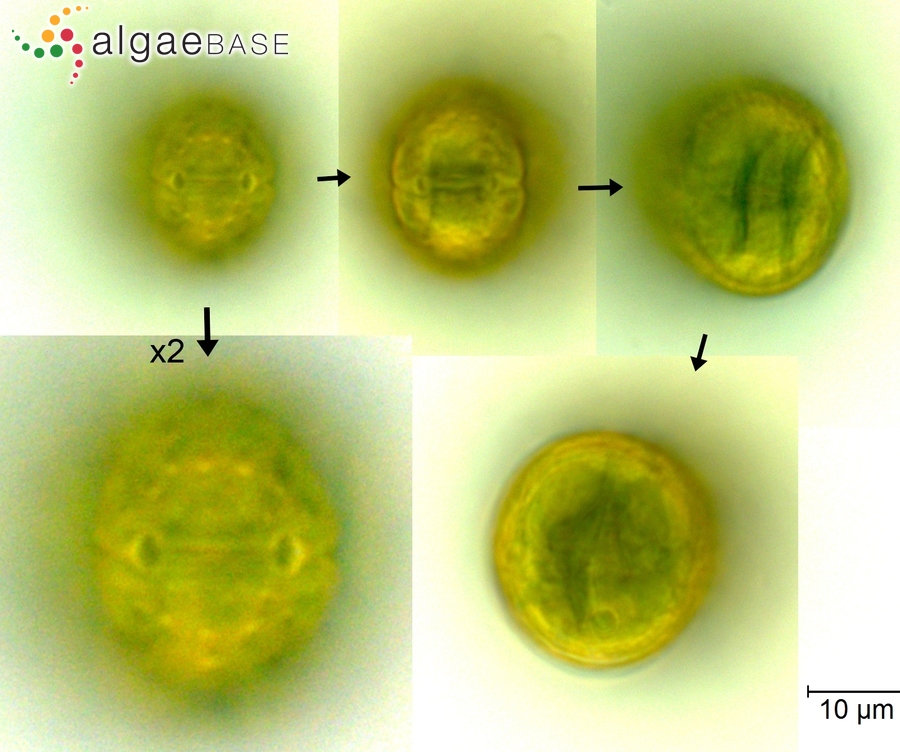 Tetmemorus granulatus Brébisson ex Ralfs