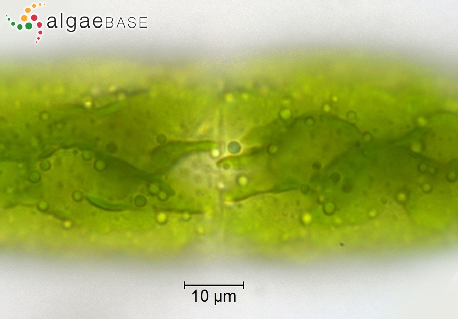 Tetmemorus granulatus Brébisson ex Ralfs