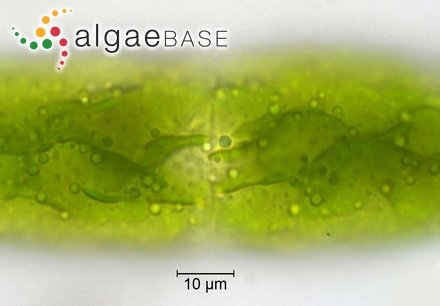 Tetmemorus granulatus Brébisson ex Ralfs