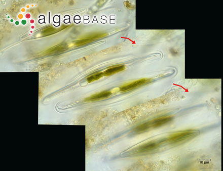 Frustulia saxonica Rabenhorst