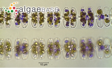 Sphaerozosma vertebratum var. latius West & G.S.West