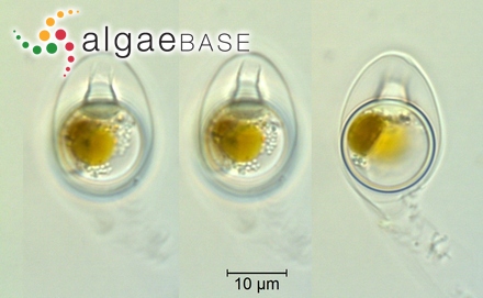 Dinobryon cylindricum O.E.Imhof