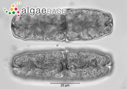 Euastrum giganteum (H.C.Wood) Nordstedt