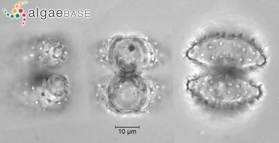 Staurastrum scabrum Brébisson