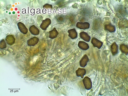 Oocardium stratum Nägeli