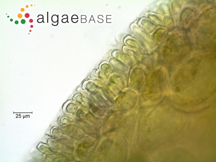 Amphiroa stelligera var. densa Kützing