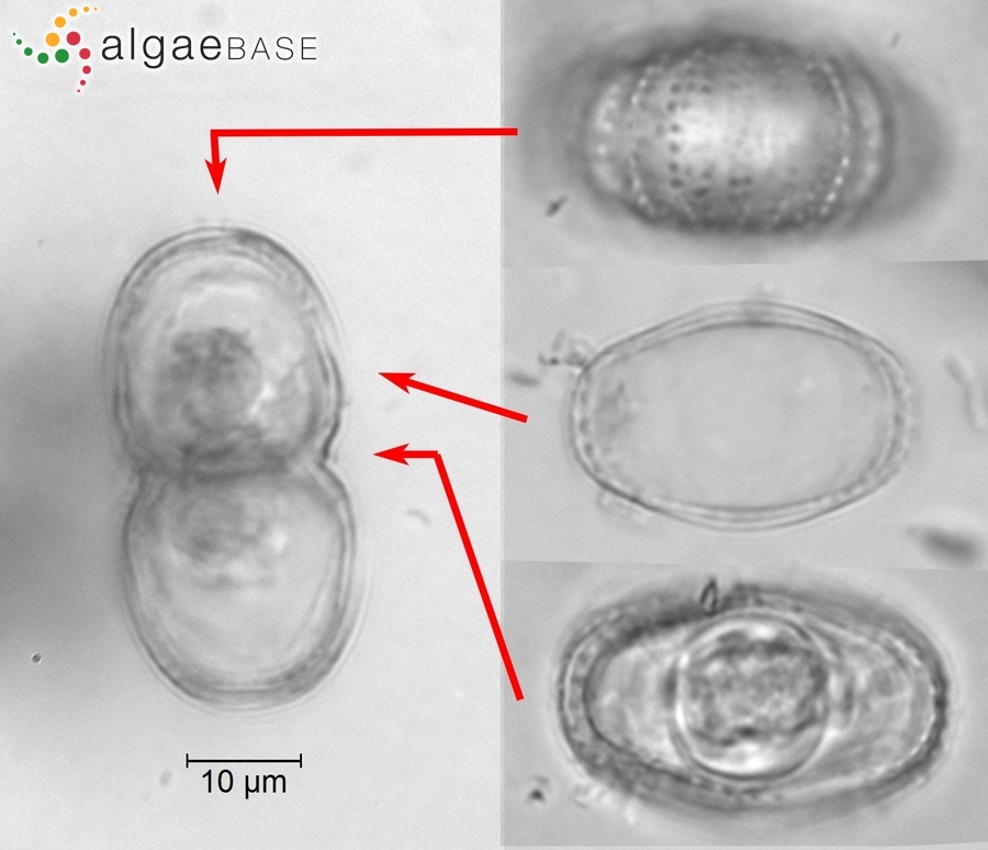 Cosmarium rostafinskii Gutwinski