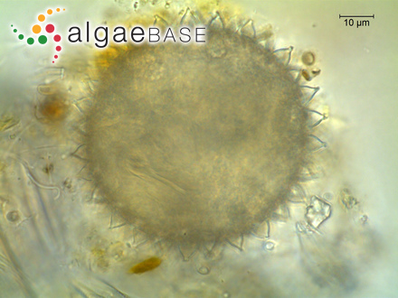 Cosmarium botrytis var. emarginatum Hansgirg